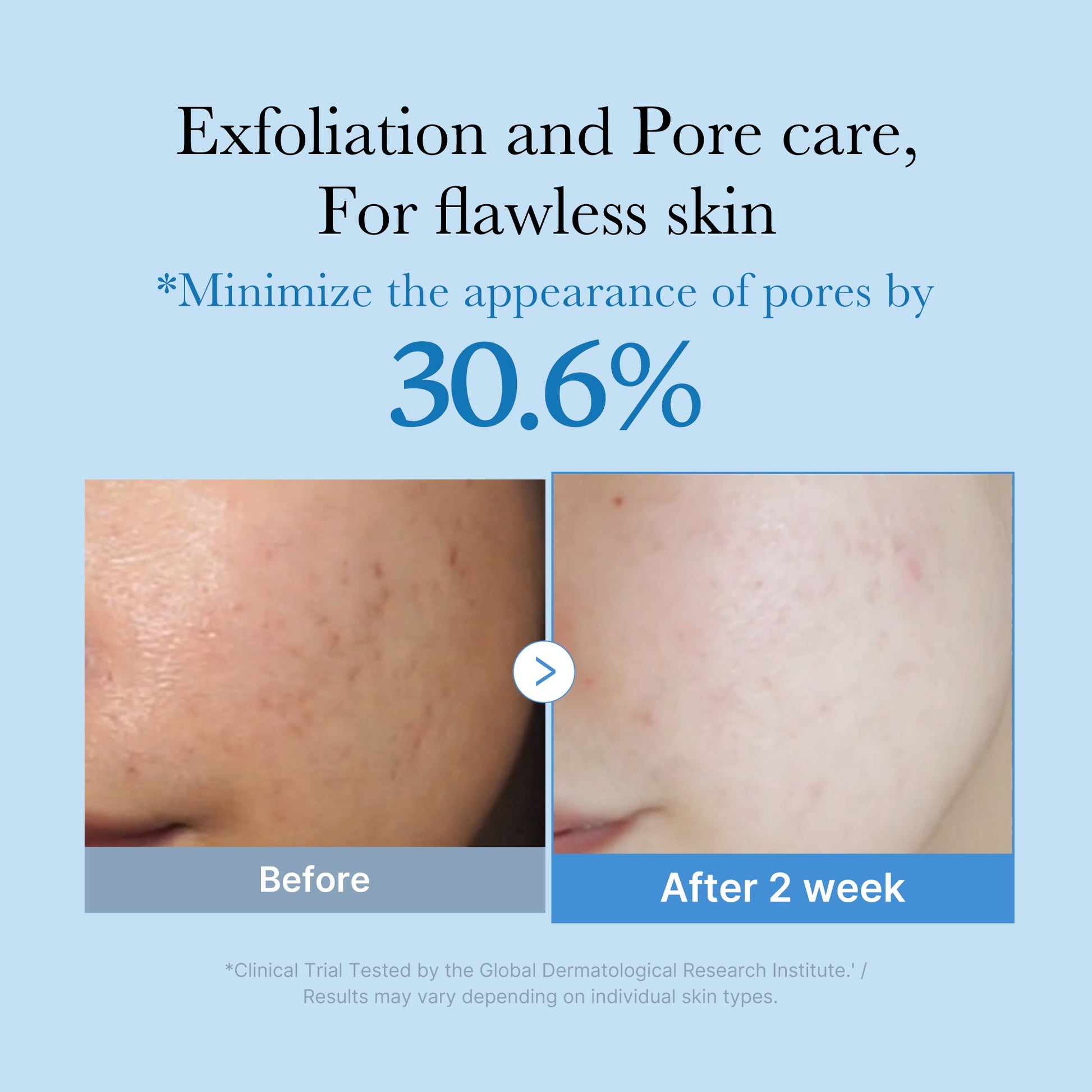 zero-pore-toner-x6 01_d6480b4e-3c08-4954-994a-ed5212c1839c.jpg