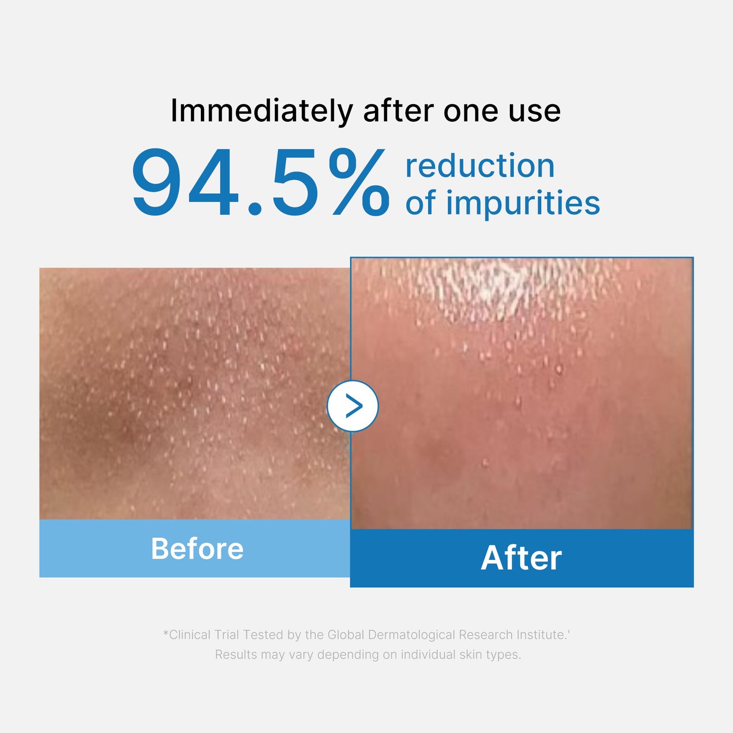 zero-pore-blackhead-deep-cleansing-oil-i7 01_eed557ec-5857-46a2-8b17-dbd67c692dcb.jpg