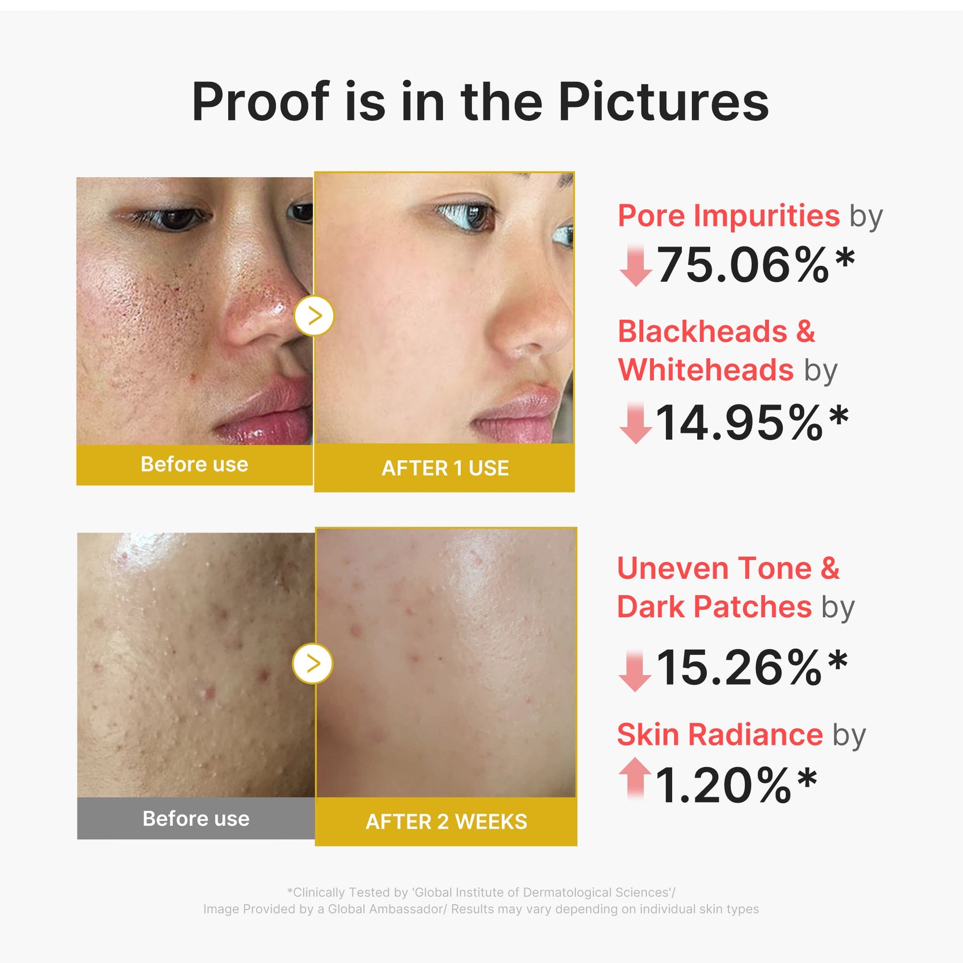 kojic-acid-turmeric-peel-shot-n5 02_45fe66d3-b3f6-4100-aa52-2afd7eded417.jpg