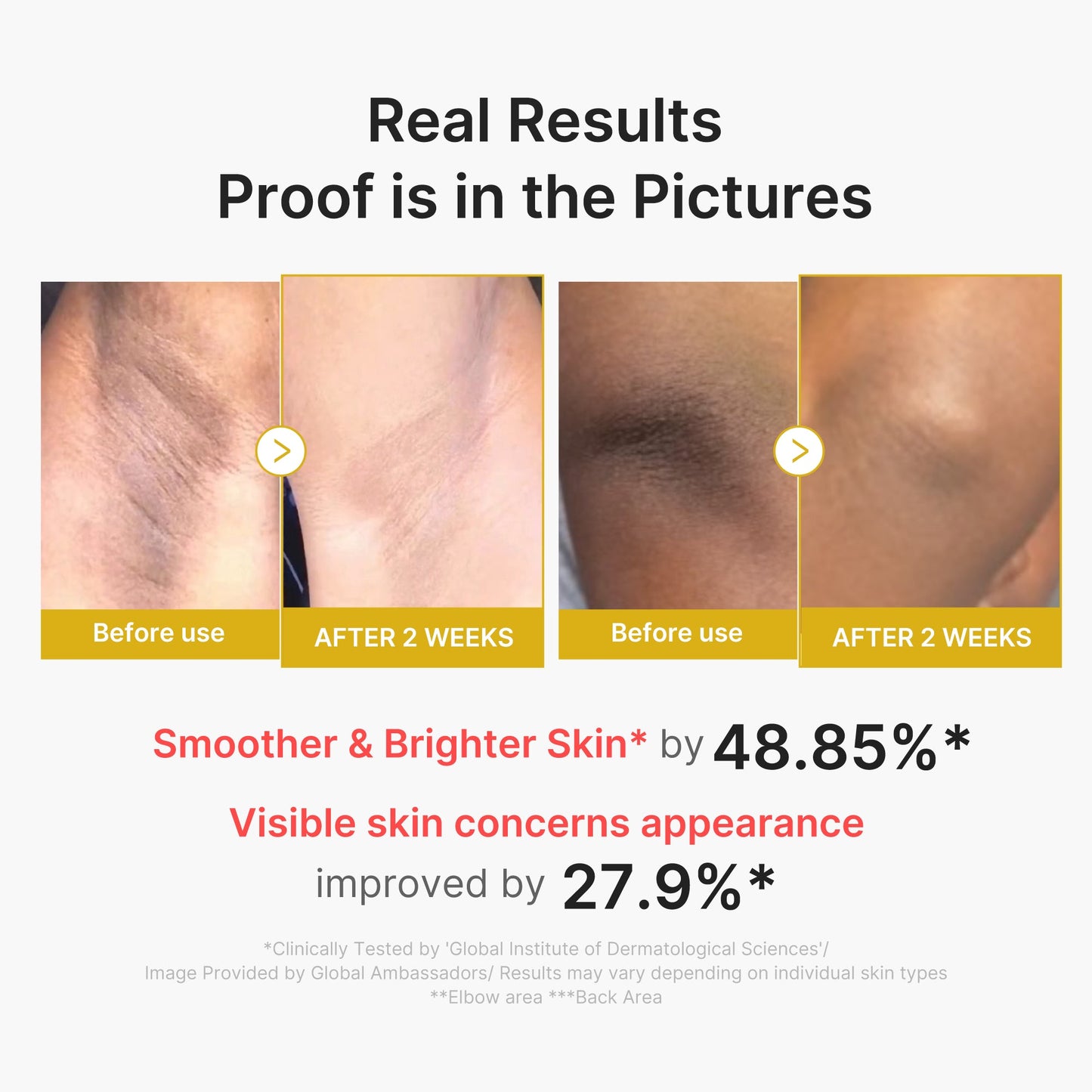 kojic-acid-turmeric-body-peel-shot-s3 02_72880cfc-382b-440b-8152-7e3dce87da2a.jpg