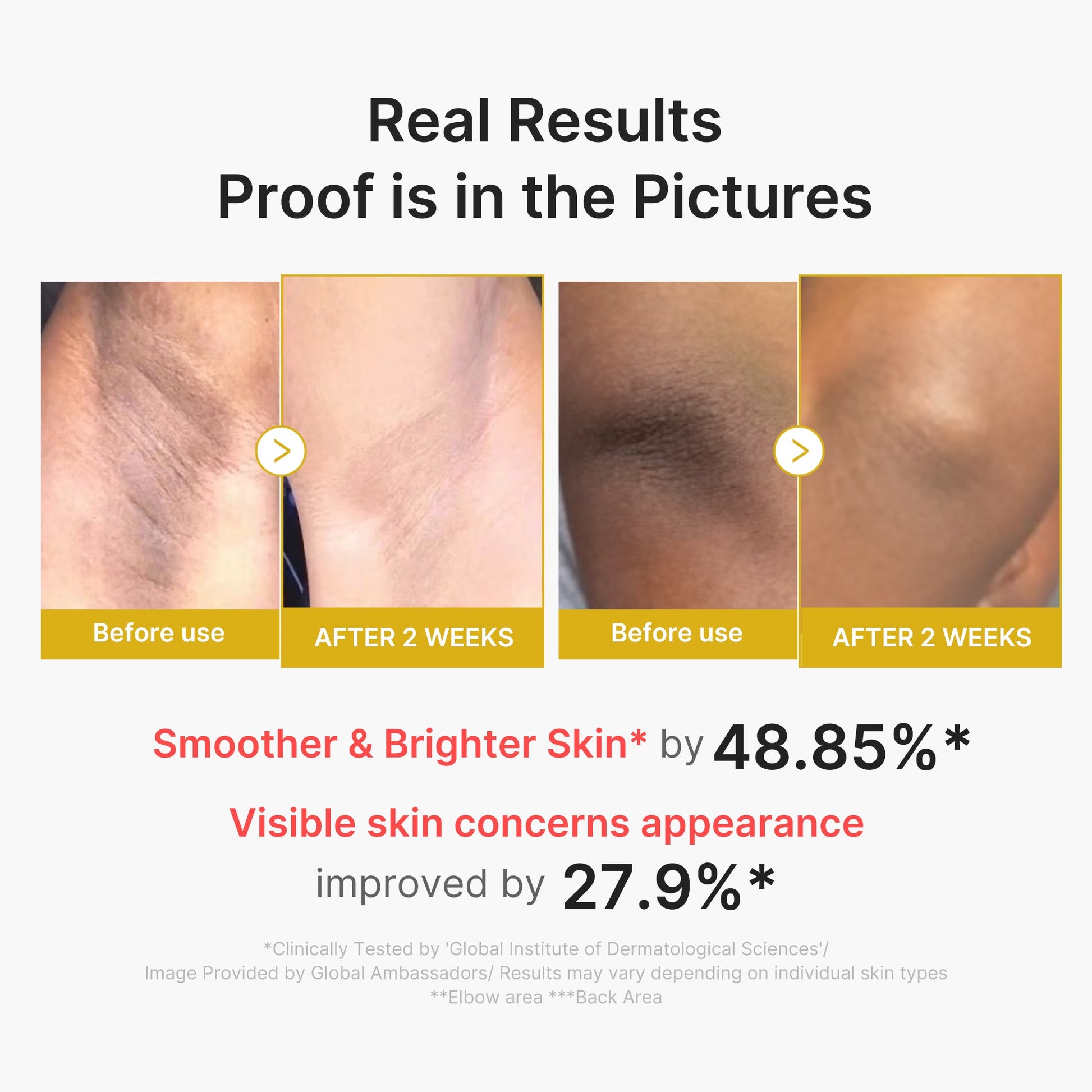kojic-acid-turmeric-body-peel-shot-s3 02_72880cfc-382b-440b-8152-7e3dce87da2a.jpg