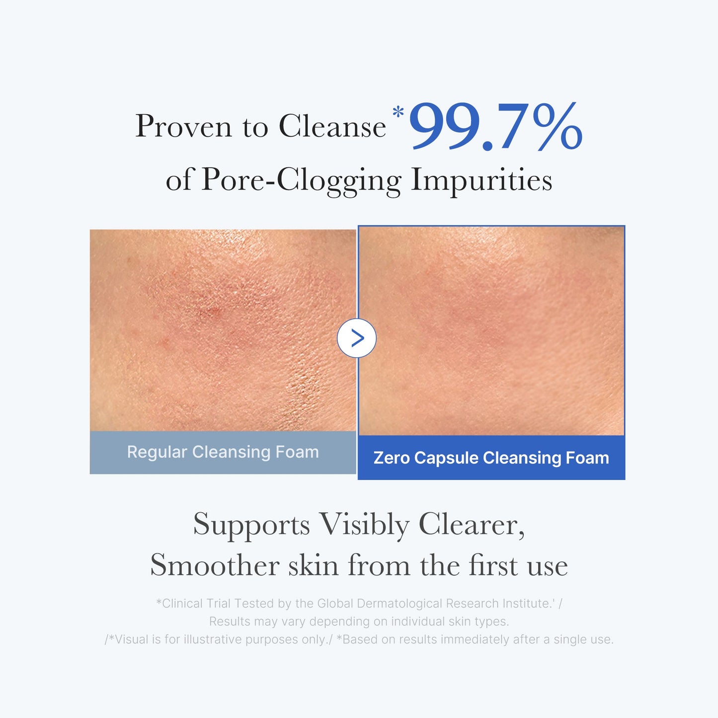 zero-pore-capsule-cleansing-foam-v2 02_c1fb9dfb-86c5-4038-8ff8-490d1006276c.jpg