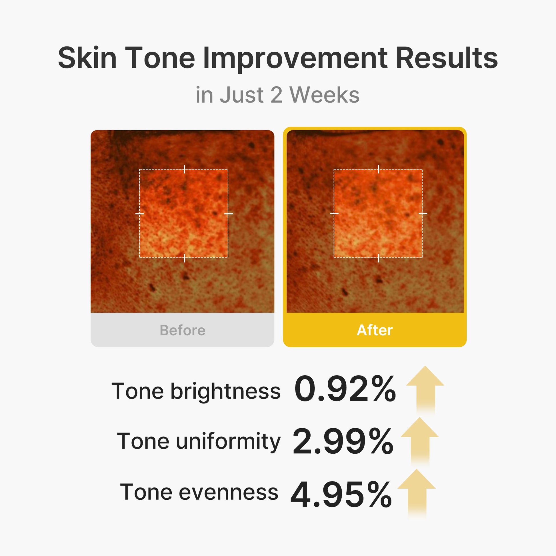 kojic-acid-turmeric-vita-capsule-cream-m6 03_2b626701-fc6c-4702-9e96-a2157a4f7f9d.jpg