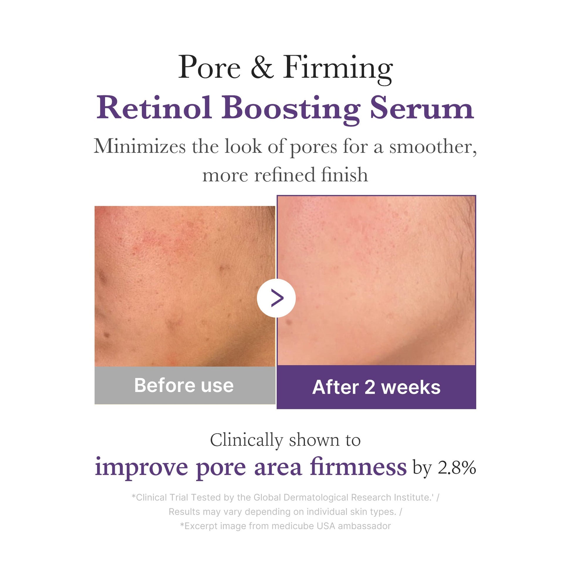 retinol-nmn-boosting-serum-x2 03_3510e7a5-5633-4a18-81ea-1389593bd517.jpg