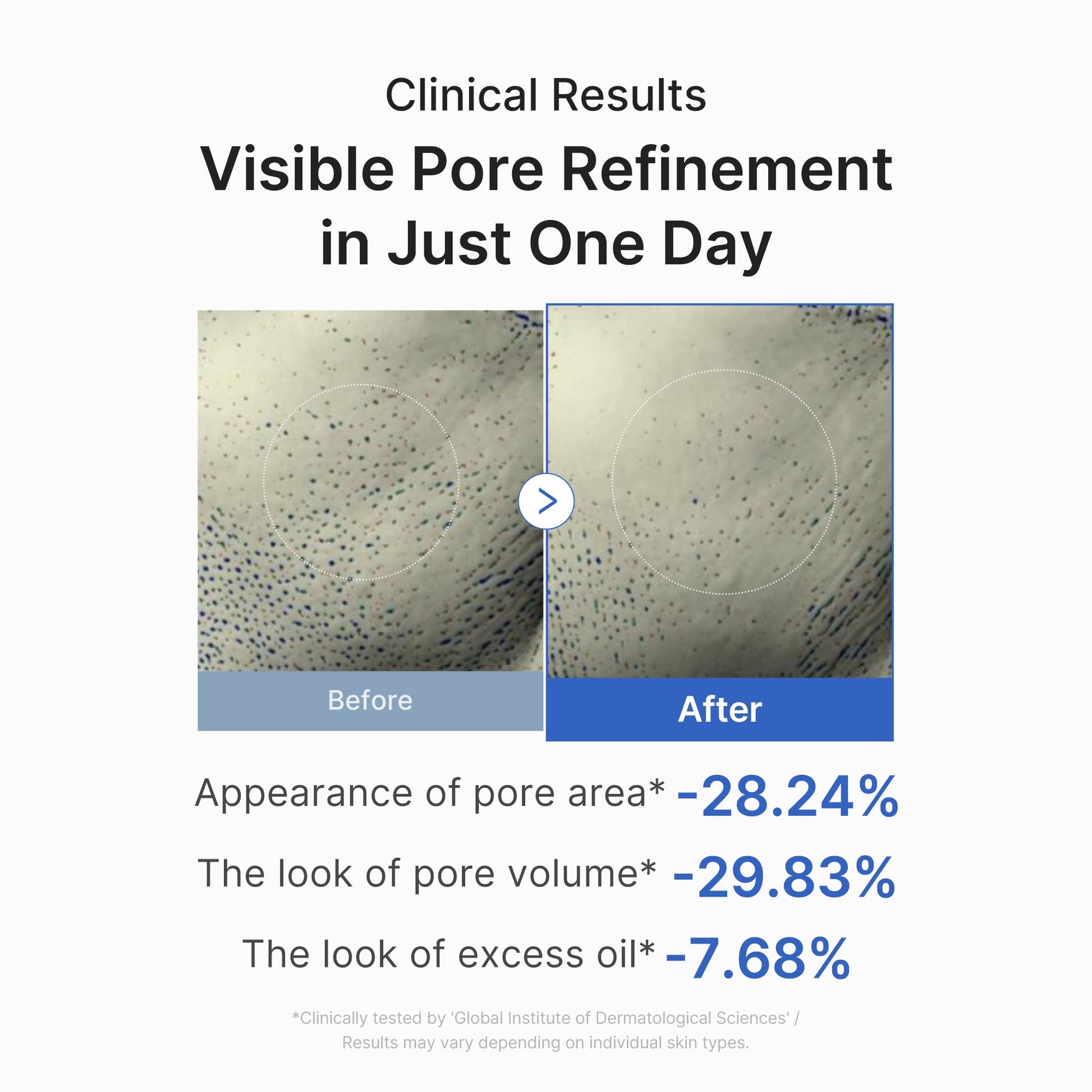 zero-pore-one-day-peptide-serum-a8 03_448eab9e-dc60-4dcb-9e4e-e863aabb61b0.jpg