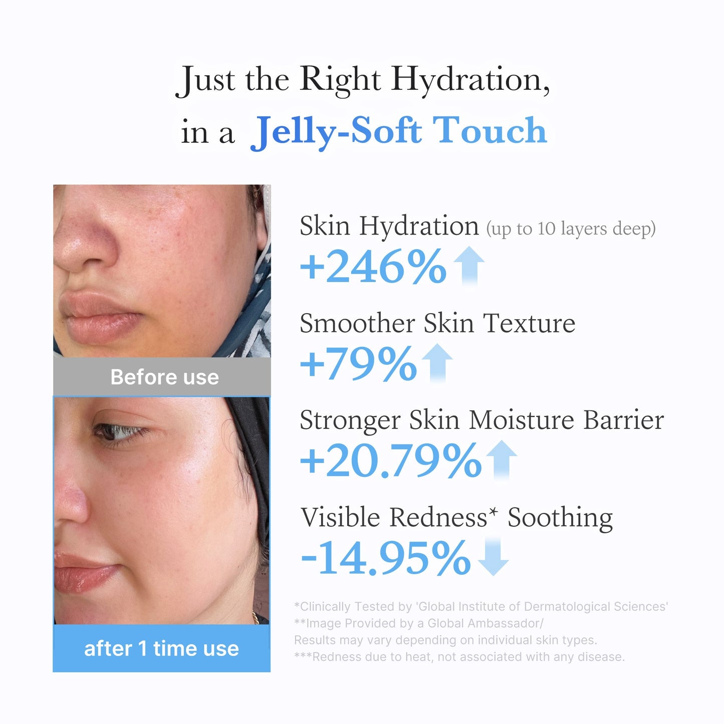 hyaluronic-ceramide-moisturizing-jelly-cream-m4 03_c39d66cc-0839-4e48-ab4a-d32143d06b1c.jpg