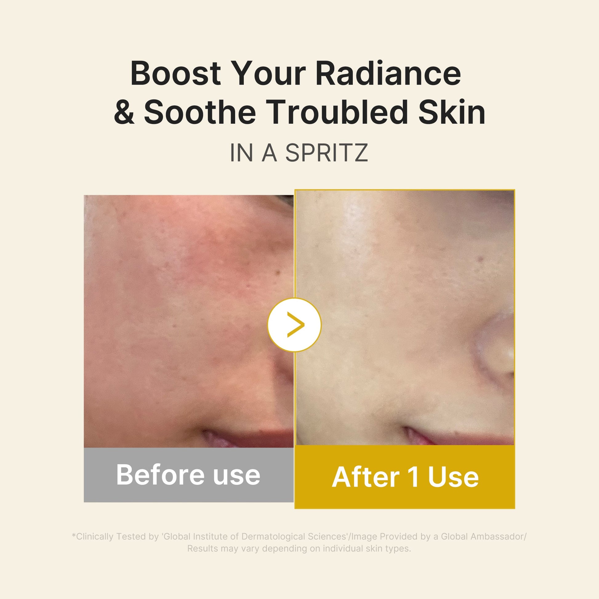 kojic-acid-turmeric-vitamin-gold-jelly-mist-serum-g8 03_dc9cd19e-4e57-49d3-9b66-c7762e8a63f1.jpg