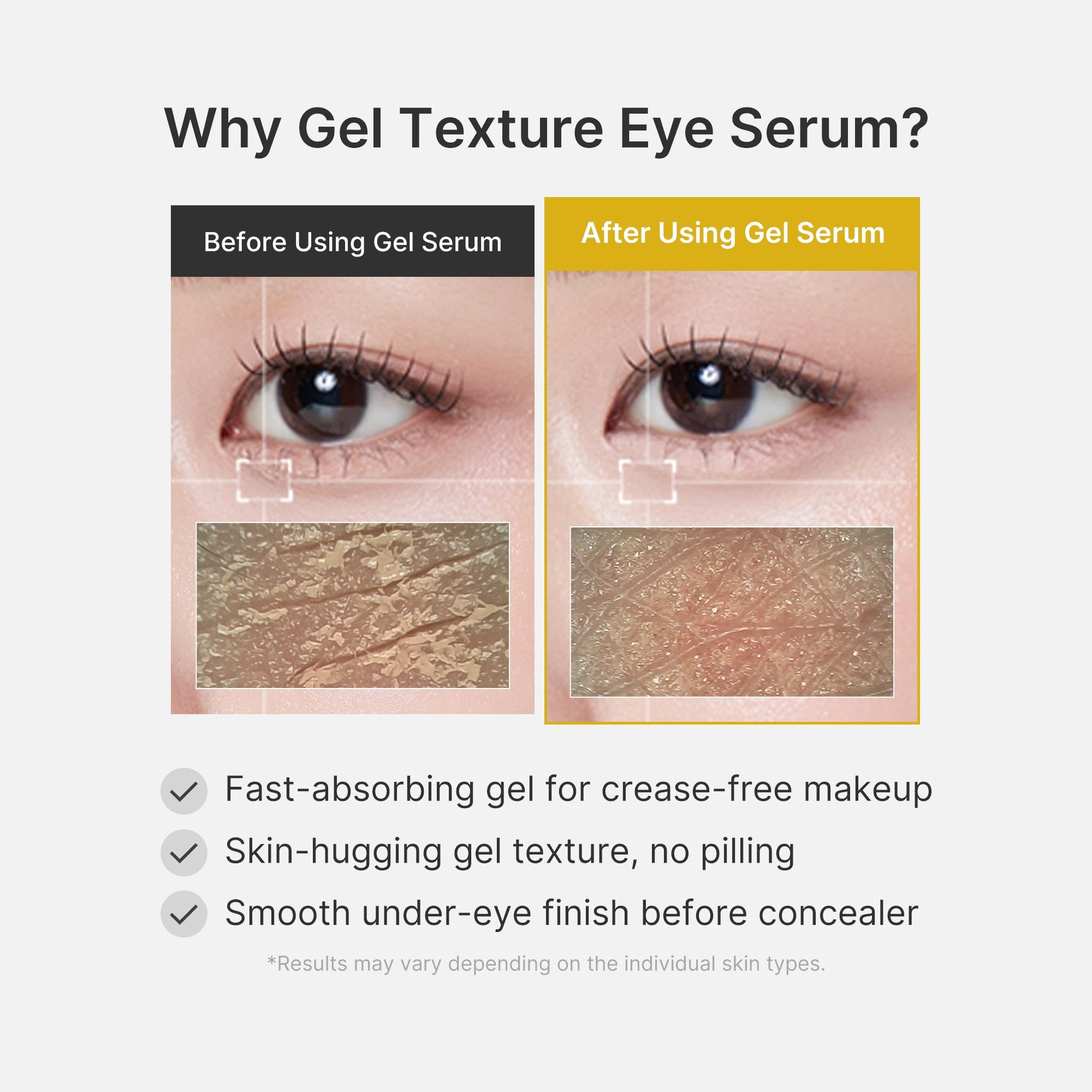 kojic-acid-tumeric-eye-gel-serum-t8 04_0487ef36-49f4-4294-8049-bb55118b05fe.jpg