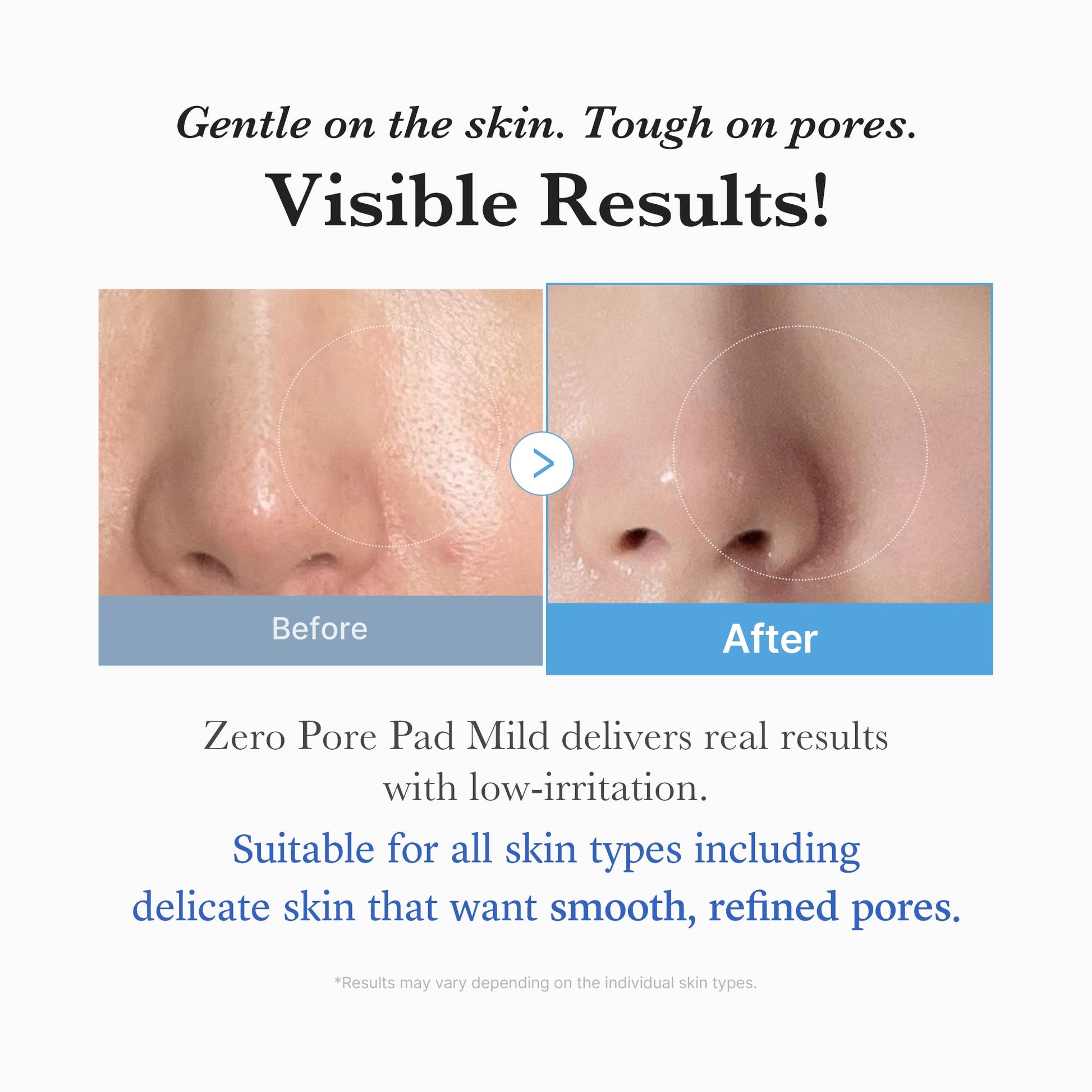 zero-pore-madecassoside-pads-mild-c2 04_6357f9f9-483b-4891-82c6-a58d336e62c8.jpg
