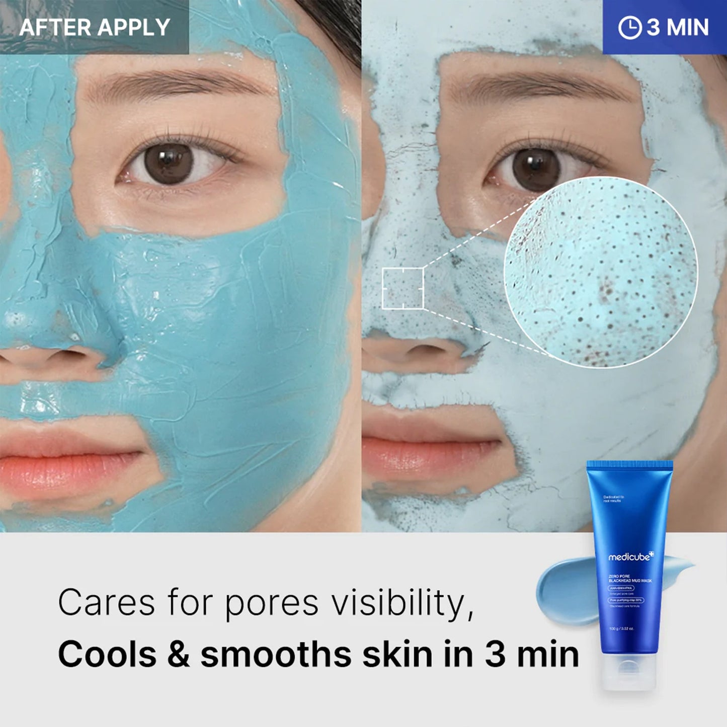 zero-pore-blackhead-mud-mask-w9 04_867c0459-a94e-40d3-bd9a-70400edabe8d.jpg