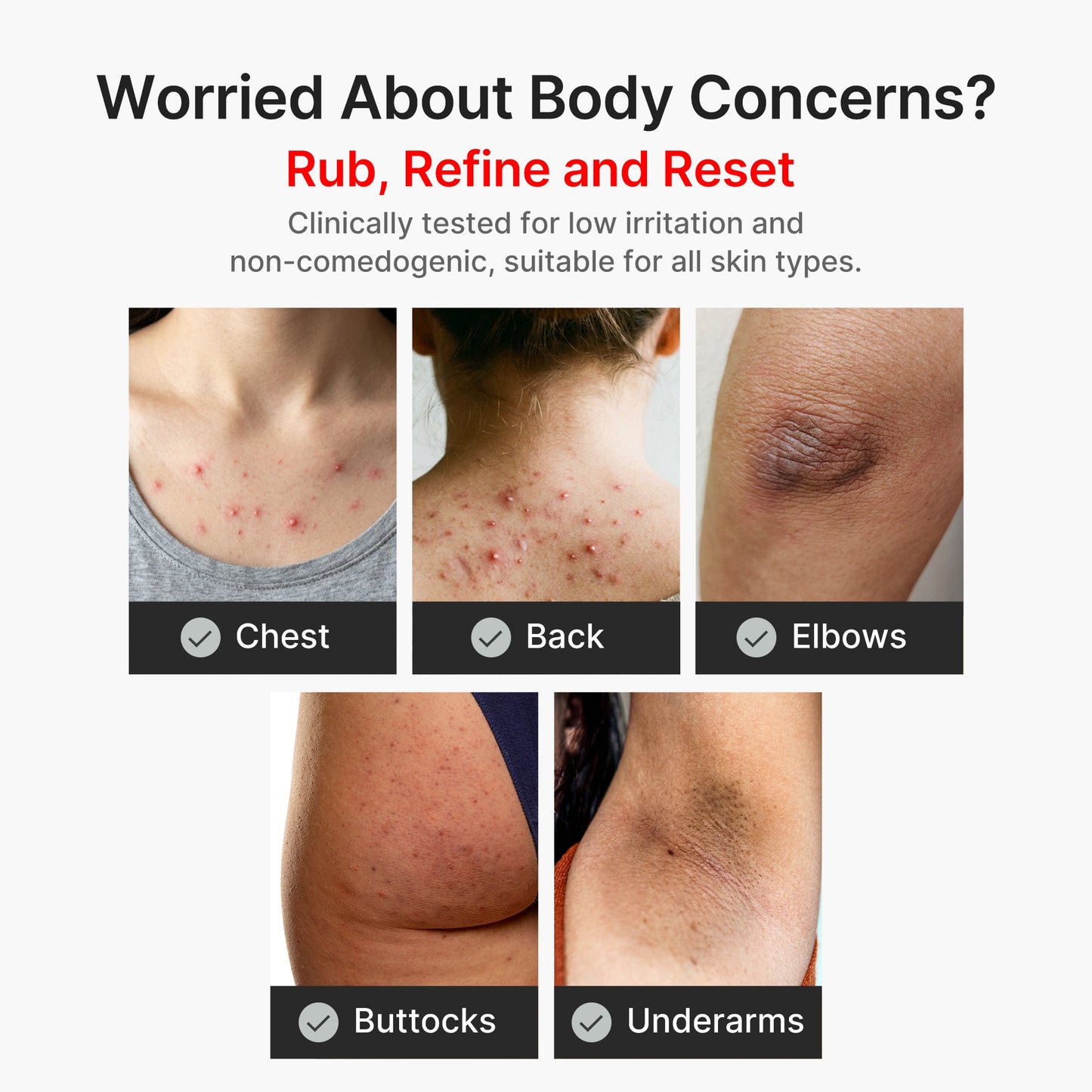 kojic-acid-turmeric-body-peel-shot-s3 04_8a7237f2-3ebf-401e-bd85-54841aeb3efc.jpg