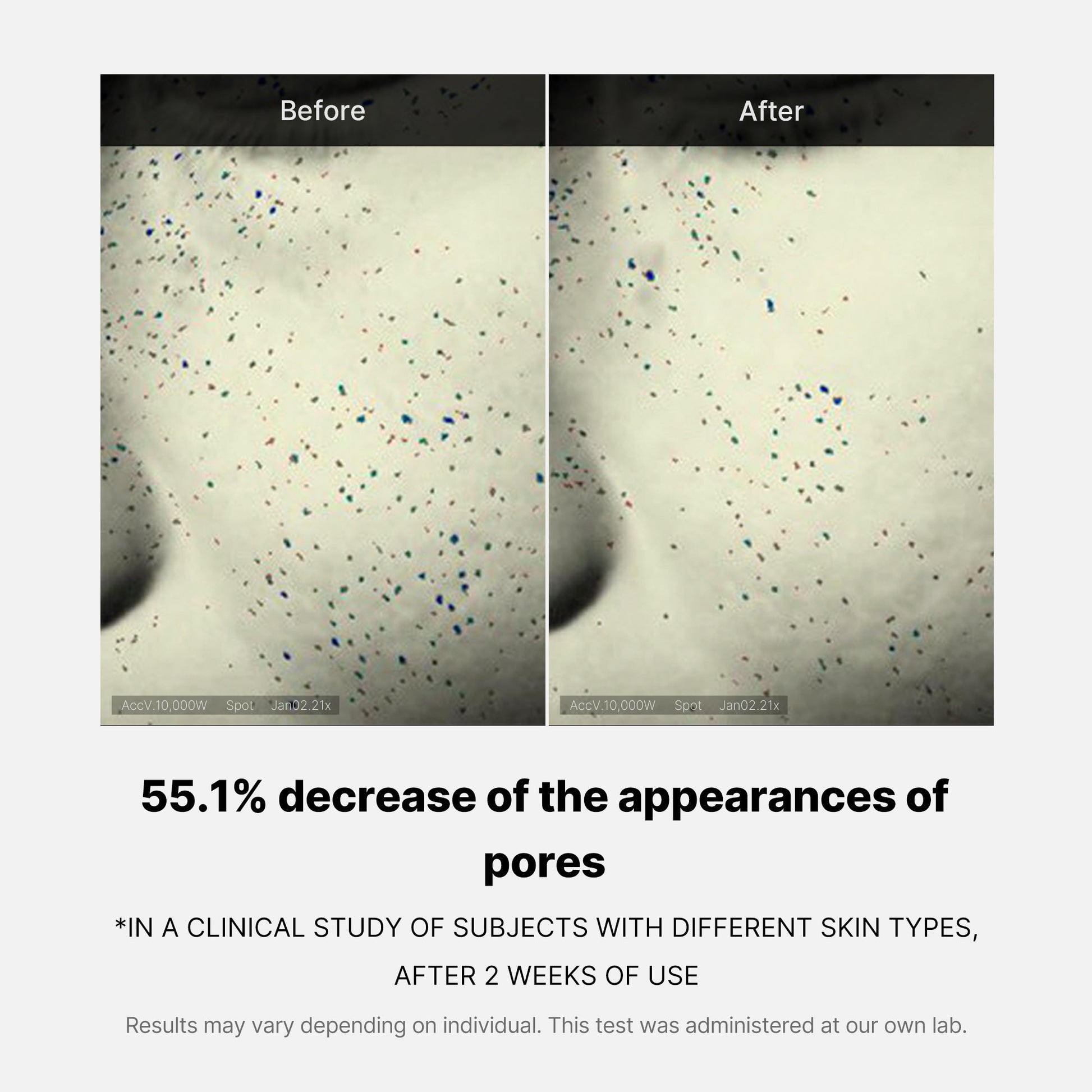 pore-care-duo-j8 05_12ddab8a-64be-4612-8ee1-27e5ec701921.jpg
