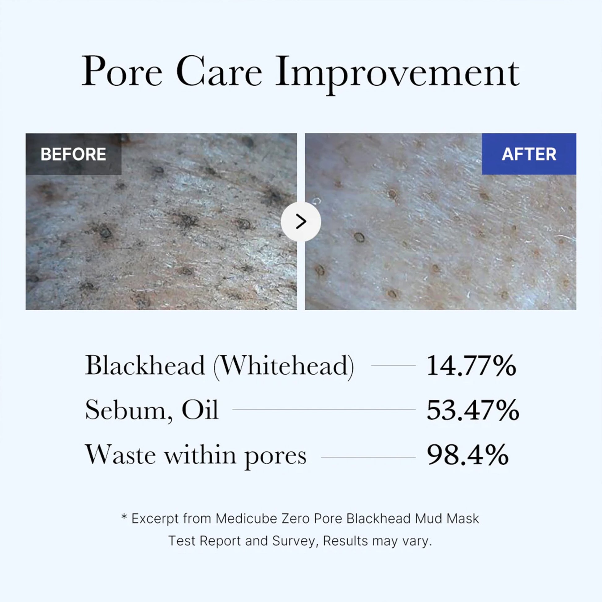 zero-pore-blackhead-mud-mask-w9 05_9362a158-c2b3-4525-acc0-631a2cfdea47.jpg