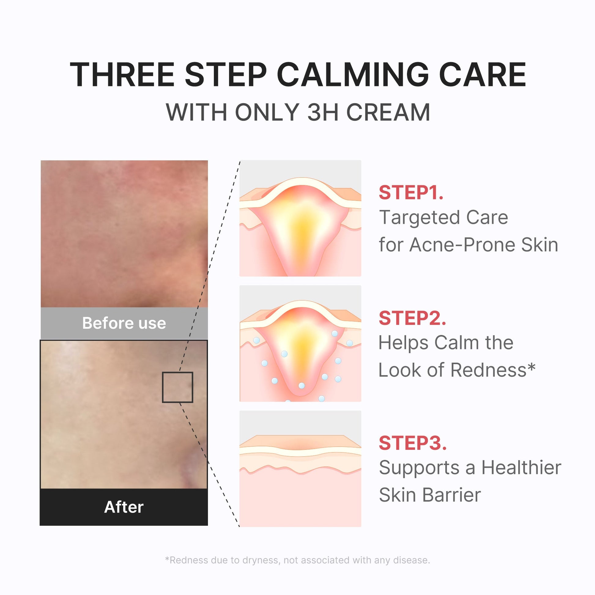 3h-daily-relief-cream-c7 3H_04.jpg