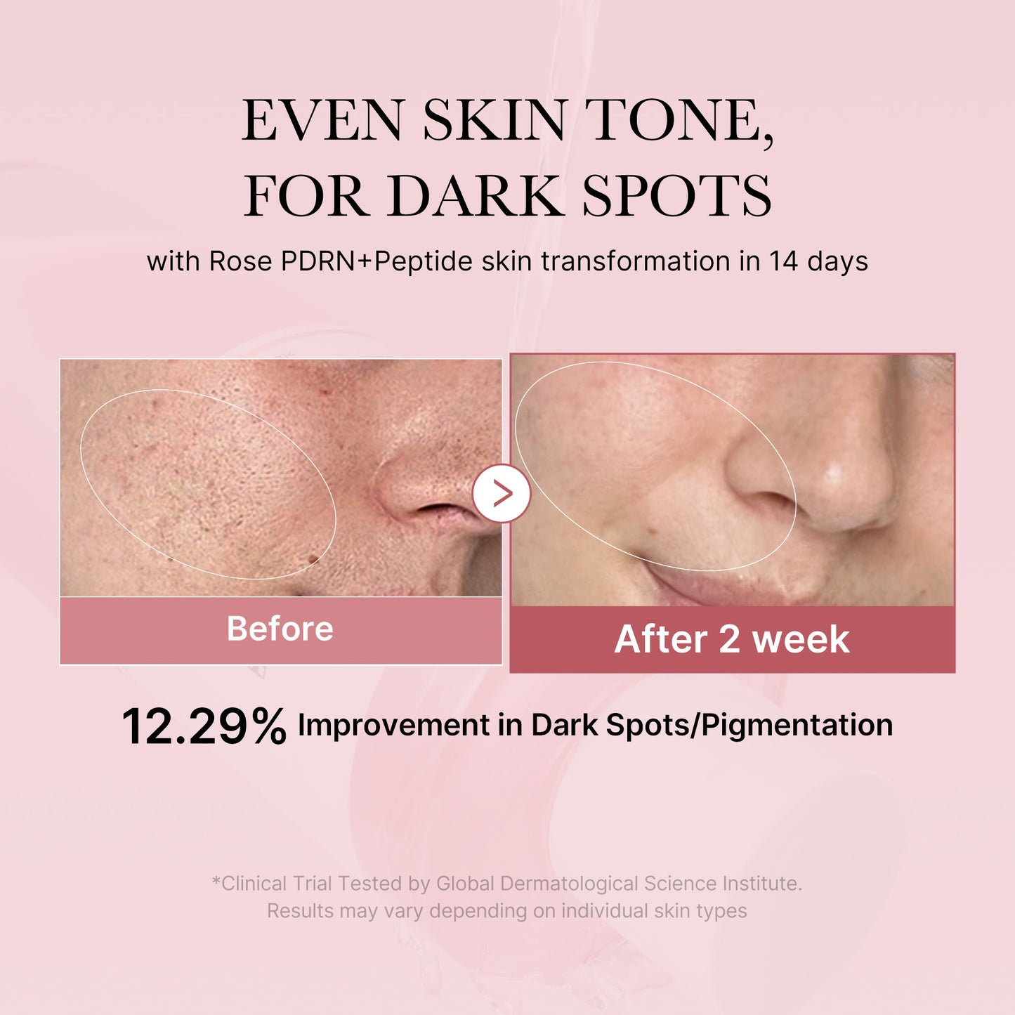 pdrn-pink-peptide-toner-f1 PDRN_01_308c518e-5ac6-4e54-99bd-eabc8796739b.jpg