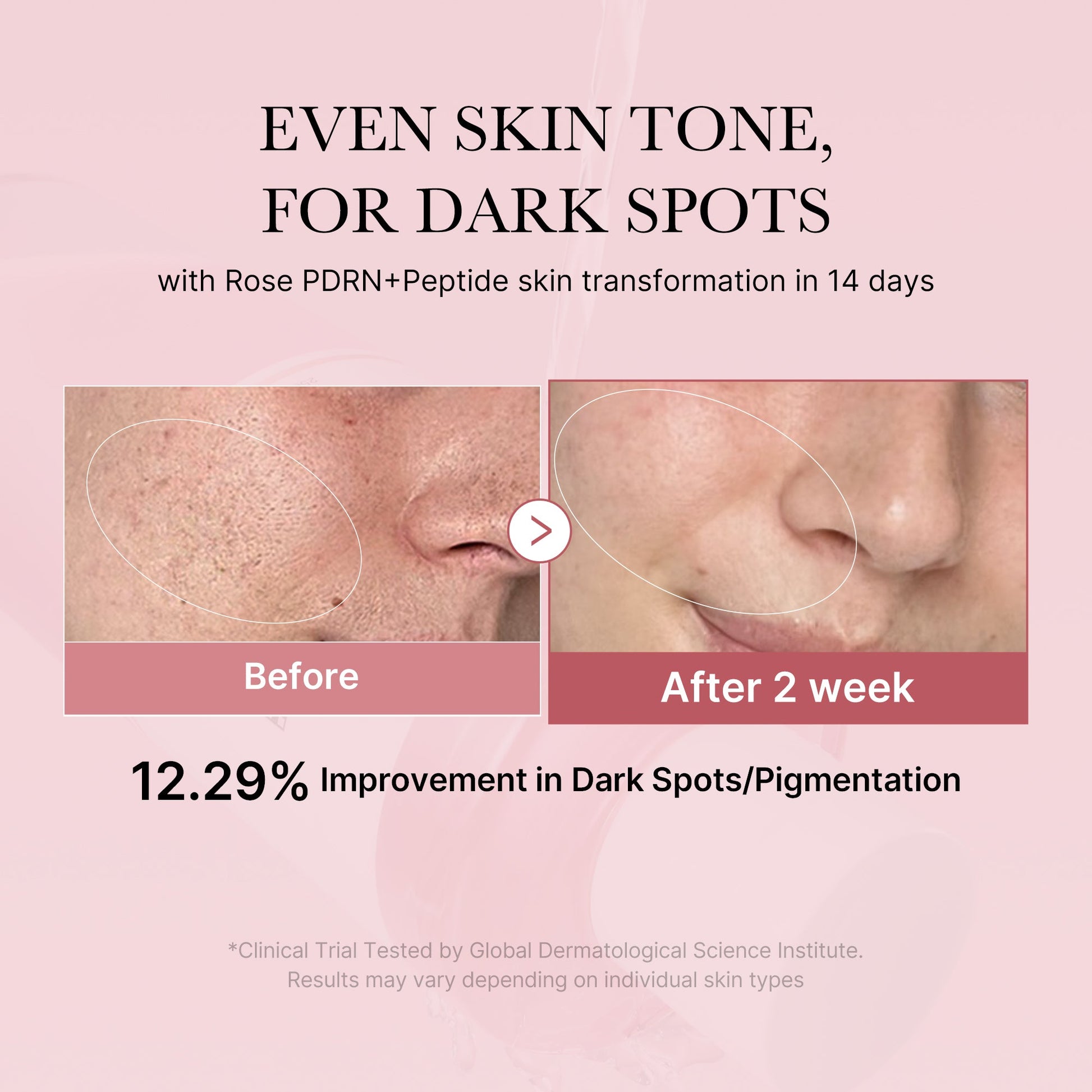 pdrn-pink-peptide-toner-f1 PDRN_01_308c518e-5ac6-4e54-99bd-eabc8796739b.jpg