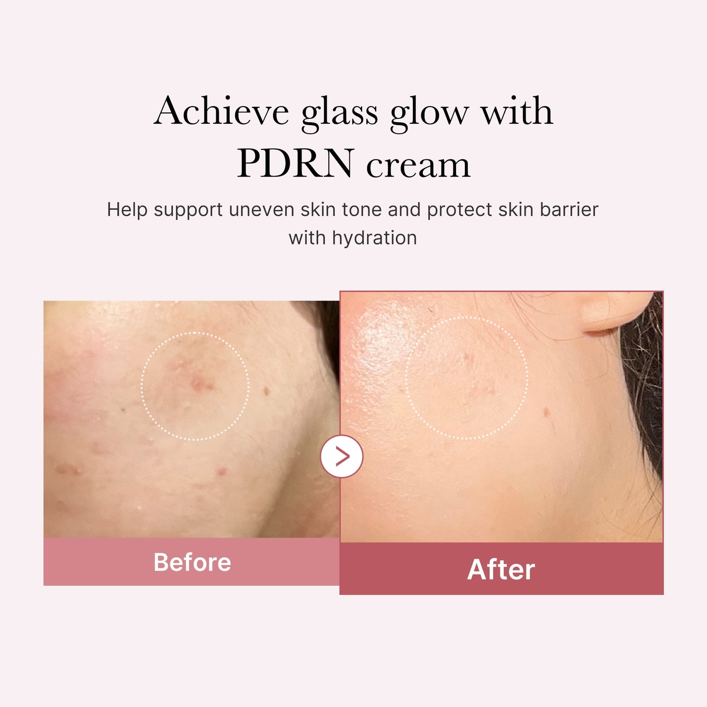 pdrn-pink-peptide-cream-f3 PDRN_02_d7805bfe-cf43-446a-b71b-a276683f136b.jpg