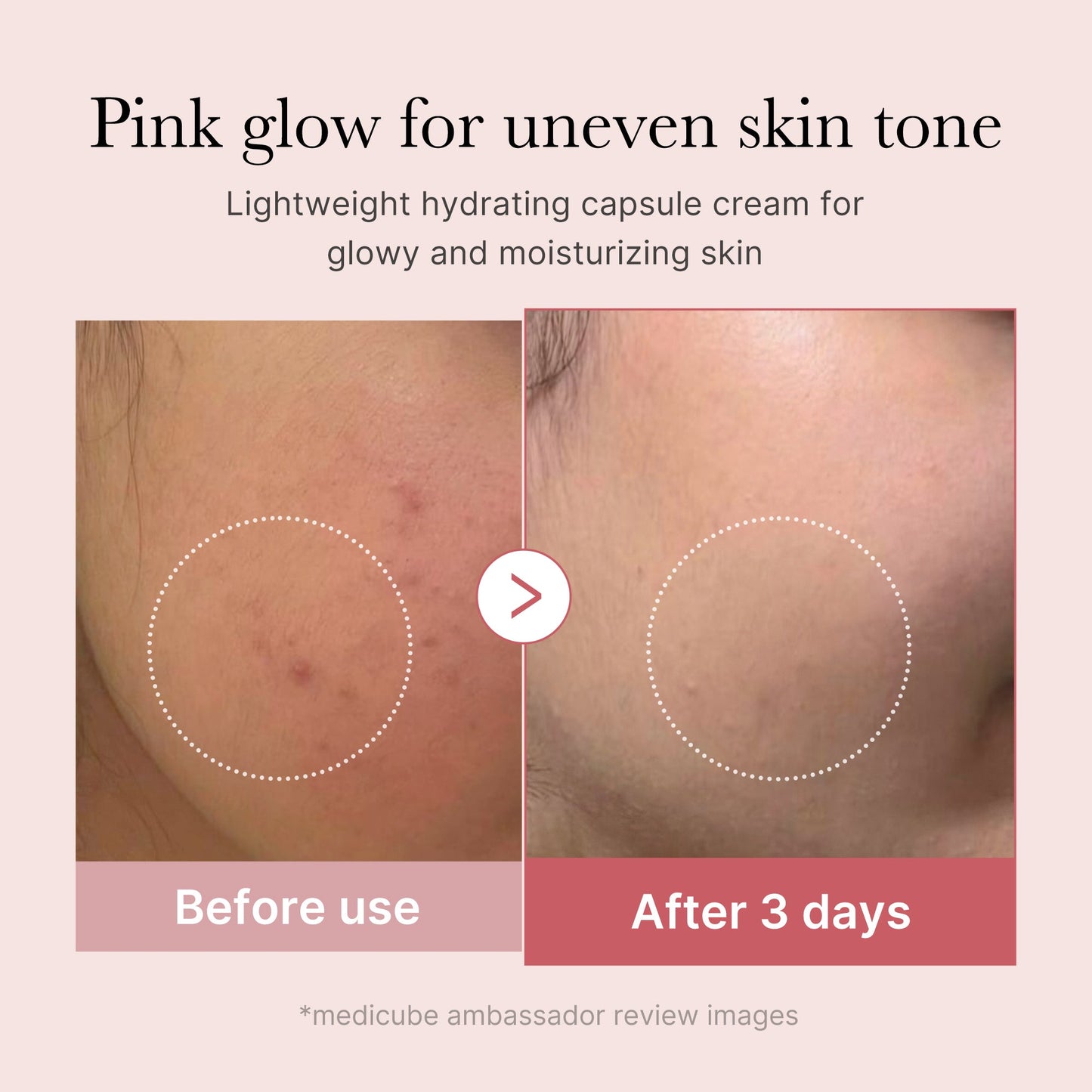 pdrn-pink-collagen-capsule-cream-x5 PDRN_03_058d09d8-4f44-4b1e-927c-e27b1738ae51.jpg