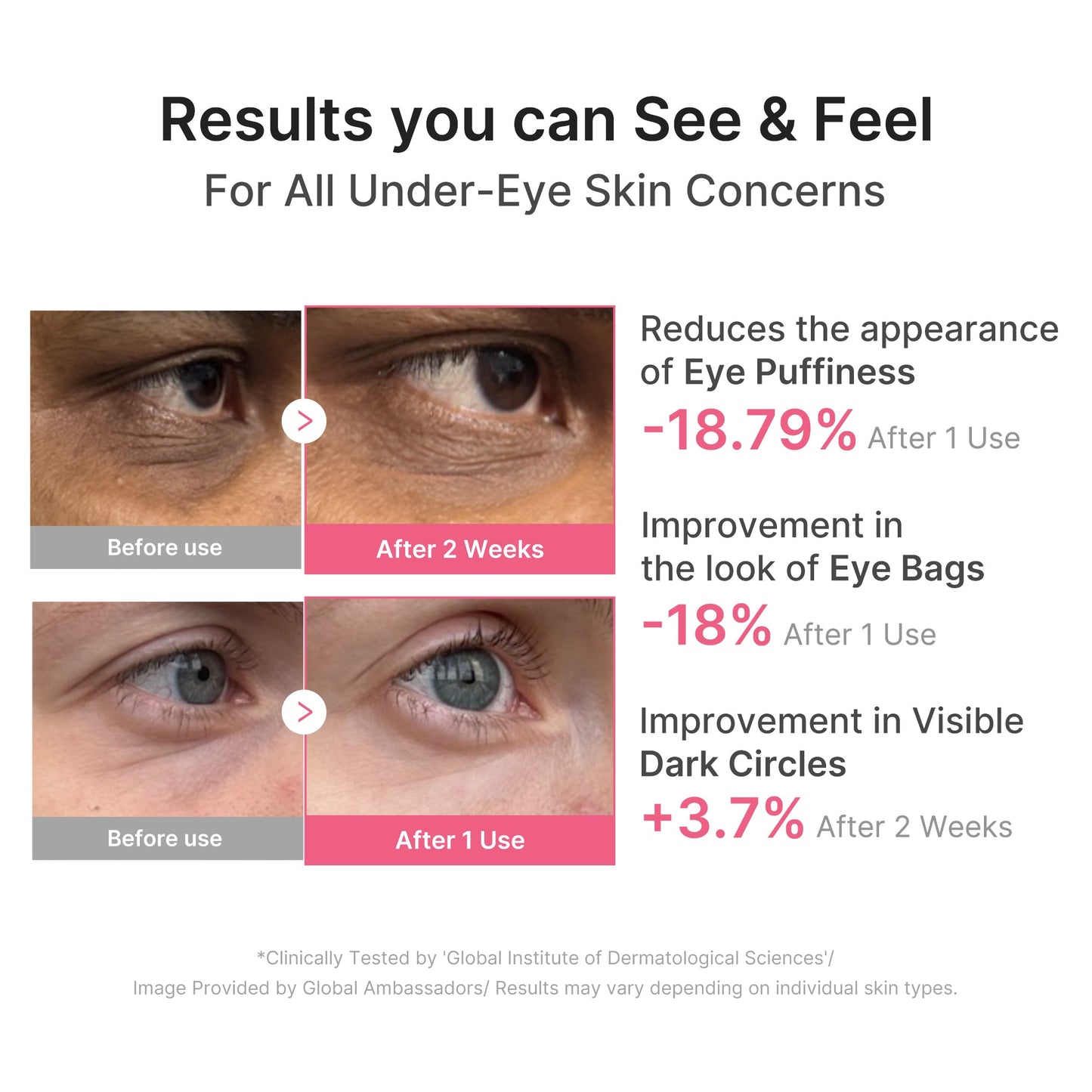 pdrn-caffeine-collagen-eye-patch-w5 PDRN_03_cdce2143-b8d8-43cb-ac69-fcbdf6640249.jpg