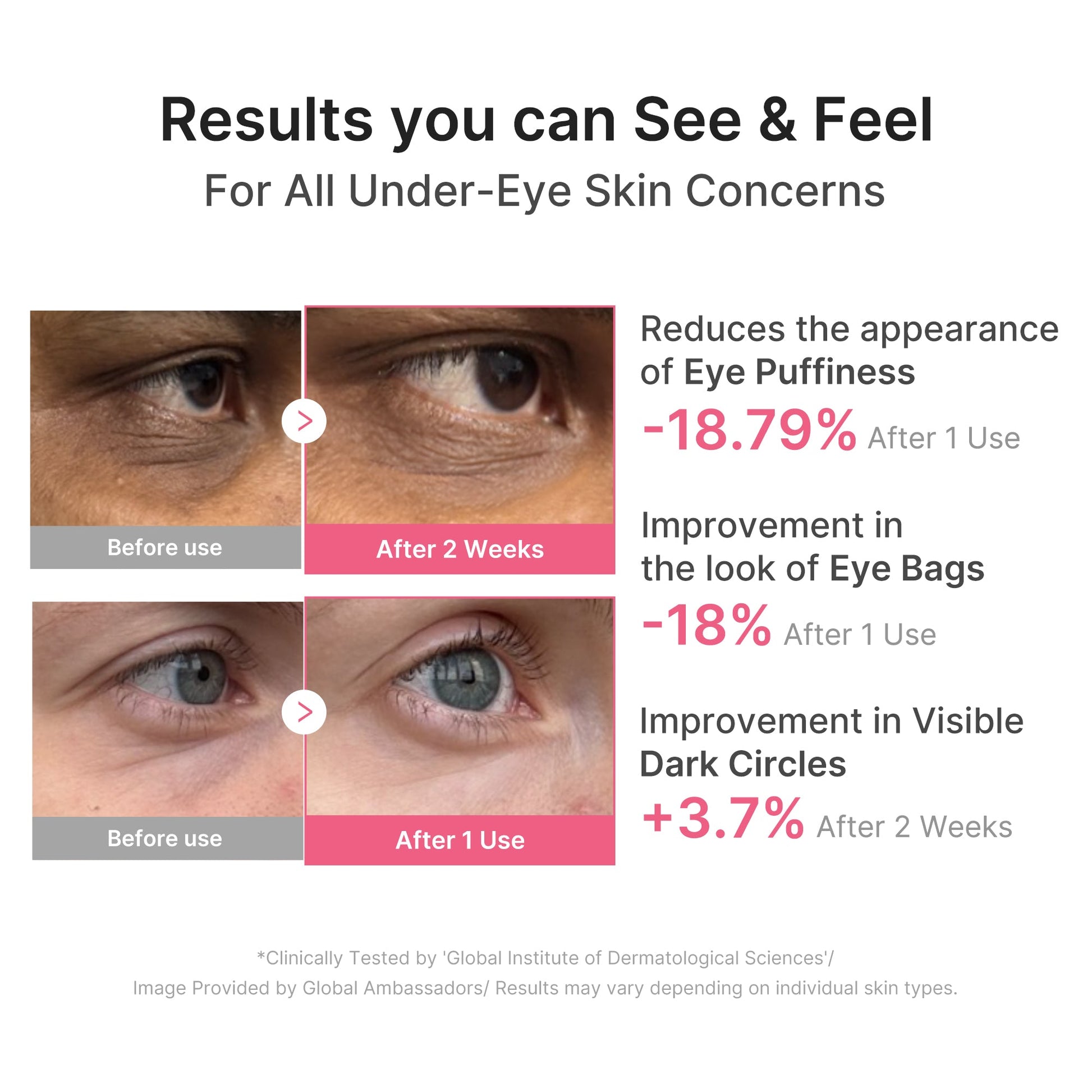 pdrn-caffeine-collagen-eye-patch-w5 PDRN_03_cdce2143-b8d8-43cb-ac69-fcbdf6640249.jpg