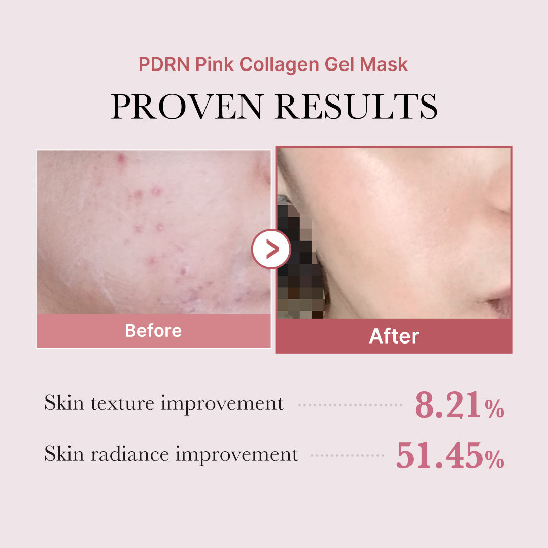 salmon-pdrn-pink-collagen-jelly-gel-mask-k3 PDRN_12.jpg