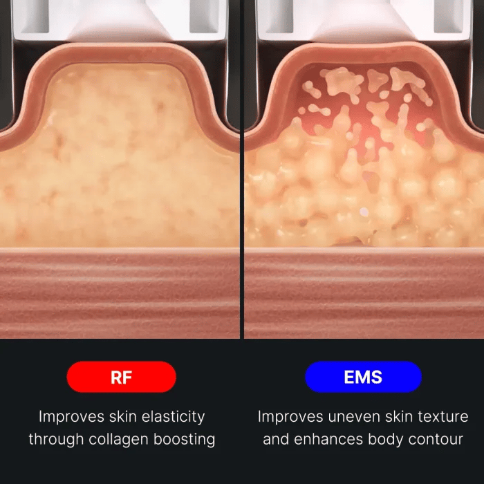 age-r-contour-body-shot-k2 img.webp